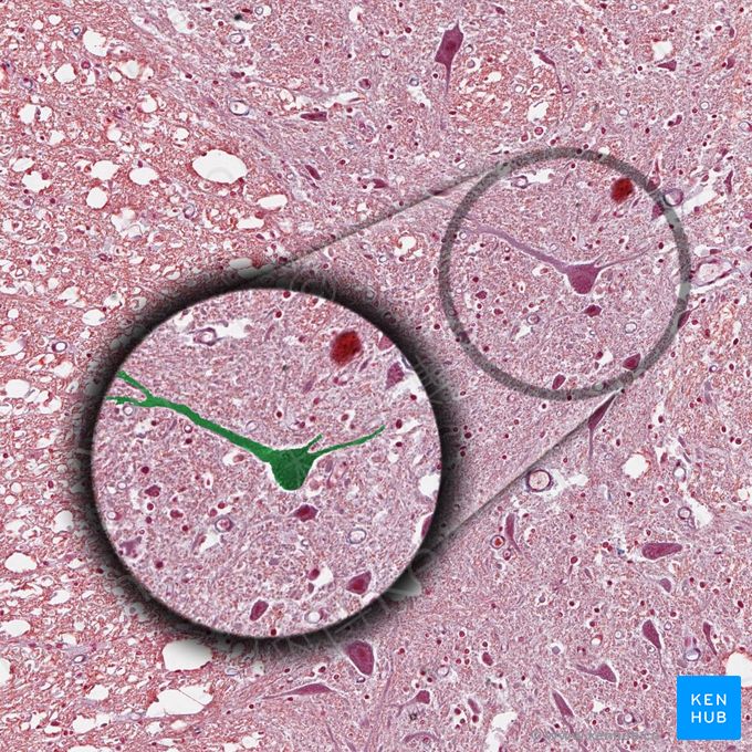 多极神经元 (Multipolar neuron)；图像：