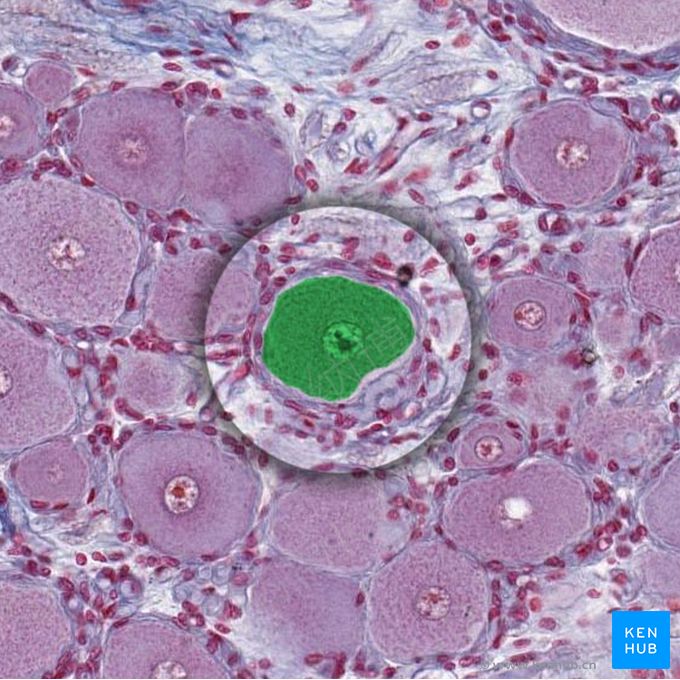 视网膜神经节细胞 (Retinal ganglion cell)；图像：