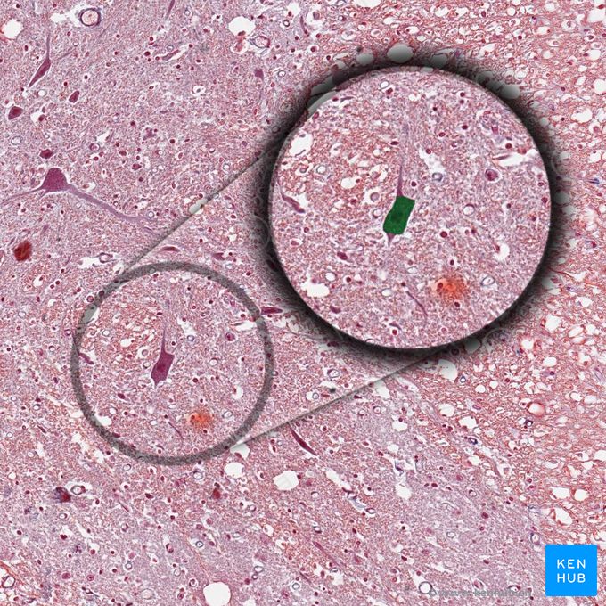 神经元胞体 (Cell body of neuron)；图像：