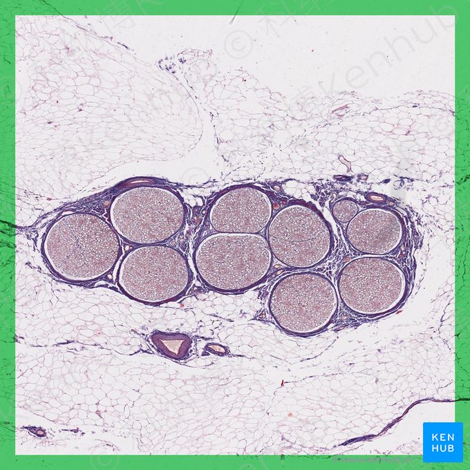 周围神经水平面 (Cross section of peripheral nerve)；图像：