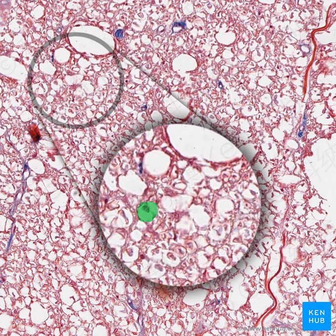 有髓神经纤维 (Myelinated axon)；图像：