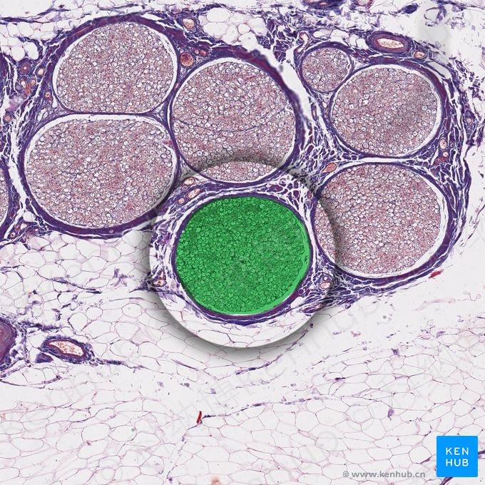 神经束 (Nerve fascicle)；图像：
